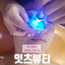 동탄 북광장 여름철 아쿠아필 모공 청소는 잇츠뷰티에서! 내돈내산 솔직후기
