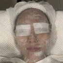 영등포피부관리 MJ뷰티에서 무통수기압출 후기