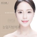 스타준성형외과 네이버블로그