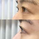썸바이솜 | 가로수길 신사속눈썹펌 바이솜 강남 맞춤형 속눈썹펌 잘하는 집 후기
