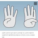 엄지 손가락으로 대동맥류 간단 테스트 해보기 이미지