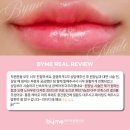 신사역 바이미성형외과 필러시술 후기만 2만 건 - 입술의 중요성 &amp; 다른 구조물과의 조화