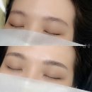 아인뷰티의원 이미지