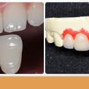 한보치과기공소 이미지