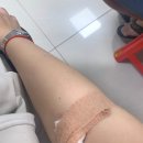 오케이참병원 | [다낭 자원봉사 후기] 노보텔 근처 다낭병원 헌혈 캠페인 참여기