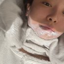 호텔포마 | 해운대 장산역 피부과 인모드 fx , 포마 , 리니어징 리프팅 , 입술필러 후기