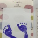 삼성연세산부인과의원 | 다산 삼성프라임 산부인과 제왕절개 3일차 후기