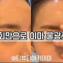 인셀덤미