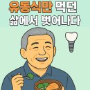 [부평치과/부평역치과/부평임플란트] 전악 맞춤형 임플란트 치료