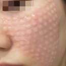 에이스피부과의원 이미지