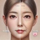 인셀덤순천 | 검버섯, 없앨 수 있을까? 홈케어로 관리하는 법! 순천인셀덤