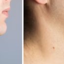 히트성형외과의원 이미지