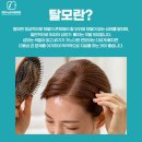 소암빌딩 | 뉴보자르, 탈모 치료 받고 나서 인생이 다시 정리된 기분