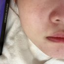 동탄하나1길 | 동탄모공관리 인스타에서 핫한 셀리올리 스킨랩 동탄점 솔직후기