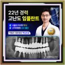 원흥치과 치아 상실 방치시 임플란트 고민과 해결 과정