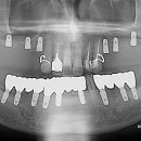 바른길치과 이미지