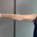 동기카크리닉 | 영등포 다이어트 팔뚝 지방분해주사 허벅지 제로팻 3회차 효과 후기