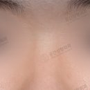 케이스성형외과