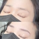 닥터브로우 이미지