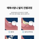 아름드리치과 이미지