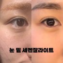박소정피부관리실 | 비싸서 고민만 했던 세멘잘라이트, 내돈내산 한 달 써본 후기