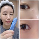 대신약국 | 패치겔보다 얇다? 약국 대신 공홈에서 구매한 픽시카겔 후기