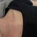 길의원 | 신사역 세레아의원 나드주사 효과 잔털제거 아쿠아필 내돈내산 솔직후기