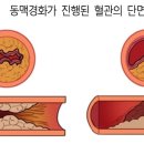 경화헬스 이미지
