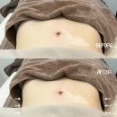 만족도 100% 수기명가 &#34;라비뉴 에스테틱 동래사직점&#34; 두번째 방문 💆‍♀️