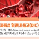 산재성 (파종성) 혈관내 응고증 혈액응고 장애 (DIC) 이미지