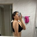 솜리갈비 | 대구 다이어트 병원 추천 팔뚝, 허벅지 지방분해주사 (3) 회차 후기