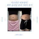 파주 운정 미소라인 피부관리 / 여자 복부비만 관리 : 복부 슬리밍관리 Before &amp; After 후기