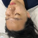 신수민 스킨케어 | 문래피부관리 신수민스킨케어 윤곽관리 안면비대칭 케어 후기