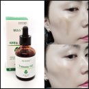 호동반점 | 타마누오일 사용법 엔코스 타마누 오일