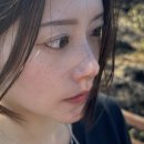 주식회사 숨앤케어 | 부산 기미주근깨 잡티제거 멜라셀케어 내돈내산 후기 및 경과