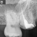 종로크라운 이미지