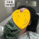 엔탑이비인후과병원 | 편도 제거 수술 결정 이유와 수술 후기 및 비용🥲 | 광주 엔탑이비인후과