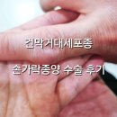손가락종양, 건막거대세포종 안산 두손병원에서 수술한 후기