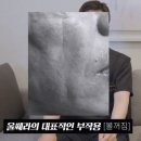 김준호의원 | 강남구청역 피부과 울쎄라 써마지 차이? 효과? 막막하다면 꼭 보세요.