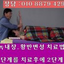 백내장 녹내장 황반변성 치료법 제1. 2단계 이미지