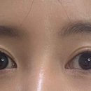 스타글라스, 위드렌즈 이미지