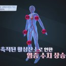 더리즈 이미지