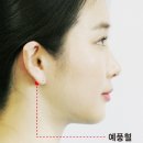 귀 부근 ‘예풍혈’, 이명·난청·두통 줄여줘 이미지