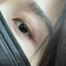 중리약국 | 마산 중리 / 한센복지피부과 / 진료잘보는곳 / 1과김상현원장님 / 전후비교 / 찐후기❗️