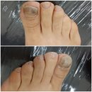 레푸스 앤 두두네일 이미지