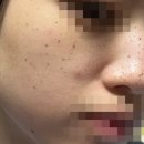 루나짐 | 루나의원 루비레이저 1일차~ 2주 후기