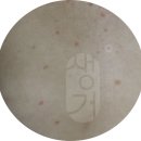 화성반점 이미지