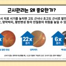 봄안경 이미지
