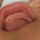 성복이안소아청소년과의원 | [D]+193 6개월차 접종 (성복이안소아청소년과의원+첫 엄마아빠!)