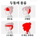 두통의 종류 이미지